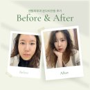 센텀6로 | 센텀피부과 온다리프팅 후기, 센텀울쎄라 같이 받으니 시너지 효과!