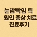 마음지기정신건강의학과 | 눈깜빡임 틱 원인 증상 치료 정신건강의학과 진료 후기