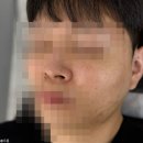 대구 파메스테틱, 제이와이뷰티에서 트러블 흔적 케어 후기