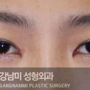 강남미의원 이미지