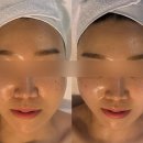 부평희망 원로의집 | 부평피부관리실 부평웨딩케어 신부관리 클레오파트라