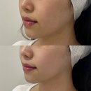 오비오 | 한 번에 모공 진정 리프팅 다 되는 부산 수영역 오비오 에스테틱 추천 후기