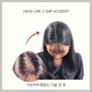 울산 🌟 드디어 찾은 헤어라인 해결책! 두피문신 체험후기 (내돈내산)