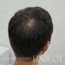 언블럿 네이버블로그