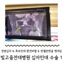 GS25전대빛고을점 | [전라권/광주] 전방십자인대 / 측부인대 완전파열 빛고을 전남대학교 병원 수술기록 1