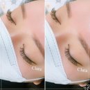 클라라뷰티라인 이미지