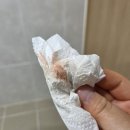 영남의원 | [ 시험관 일기] 창원엘르메디여성의원에서 난자채취