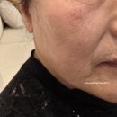 밴스의원 | [밴스의원 원주점] 어버이날 선물후기 내돈내산