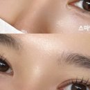 스마일메디칼 이미지