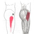 대퇴근막장근(tensor fascia latae) 이미지