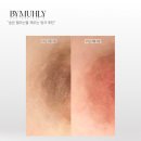 분이네속눈썹 | 개포동 그레이스라운지 출산 후 바이뮬리 멜라닌케어 솔직후기 대만족