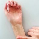 주식회사 시와이피 | 러브오일 와이존 건조함 해결 후기