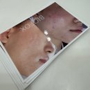 파주 운정 에스테틱 운정뷰티온 탄력관리받고 온 솔직후기
