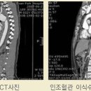 외상으로 인한 대동맥 손상 - 증례 보고 (인제대학교 일산백병원 장우익) 이미지