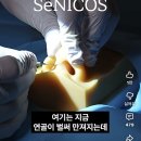 코끝 성형 수술 과정 같이볼사람 이미지