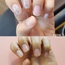 썬네일#SUNNAIL# | 부평네일 손톱&발톱갈라짐 케어는 썬네일