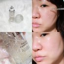 꿈의약국 | 모공앰플 추천 NMN화장품 로에르네 소개팅 앰플 사용 후기