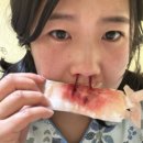 하나이비인후과 | 울산 하나이비인후과 축농증 수술 비용 리얼후기