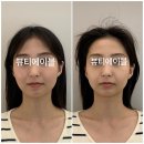 뷰티에이블 - 진주시 | (진주비대칭) 뷰티에이블, 두골비 비대칭 관리 후기