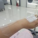 대전 세이유외과에서 유방 양성병변 제거술이라는 맘모툼 수술했어요