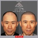 사단법인경찰공제회강남의원 | 2년을 지켜본 홍대 미대출신 화가의 두피문신 영등포 루브르스칼프로 선택!!