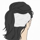 편한M약국 | 여자 모발이식 M자탈모 헤어라인 절개 3500모 수술후기 2화 (주의사항, 수술과정, 통증)