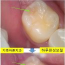 더바른치과기공소 이미지