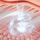 온담한의원 | 백온담 마사지기 목 어깨 이렇게 달라져요 효과 후기