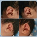 삼성병원 맞은편 | 삼성미래여성병원 출산 후기ㅡ 제왕절개 4일차