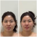 213 | 리프핏 남양주다산점 윤곽관리 내돈내산 후기