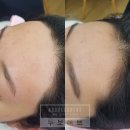 가람헤어라인