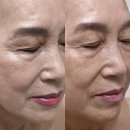 H-015 | 검단 피부관리 브로우살롱H 잔주름 펴주는 크레이지015 고주파리프팅 후기