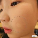 밝은빛 태권도 | 초등 아이 얼굴에 하얀 반점, 첨단 셀피부과 진료 5회차 후기 (백반증일까?)
