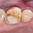 누가치과기공소 이미지