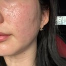 (주)파란환경 | 리투오 내돈내산 후기 솔직후기 가격 통증 모든 정보 등