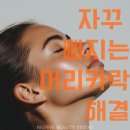 정수리탈모,헤어라인탈모 SMP로 인상바꾸기