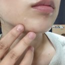 진 메디케어 이미지