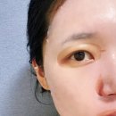 메디힐케어 | 톤케어 마스크 추천, 메디힐 마데카소사이드 에센셜 마스크 흔적 리페어 후기