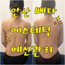 안산 빼다 에스테틱 예신관리 받고왔어요!