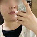 일산피부과 정발산피부과 온다리프팅 내돈내산 후기