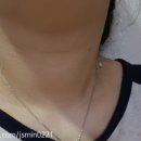 투에스엘 이미지