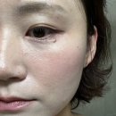 개미광고기획 | 올리브영 비플레인 녹두 클렌징오일 더블기획 내돈내산 찐후기 블랙헤드 모공딥클렌징