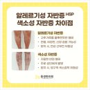 경화반점 이미지