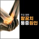 서울신정형외과의원 | 팔꿈치 통증, 혹시 이런 질환? &lt;음성 대소면 서울신정형외과&gt;