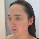 [화성/동탄] 25년 경력 프리미엄 동탄 영천동피부관리:휴앤미에스테틱