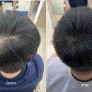 다솜헤어라인