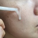 비상롱제비티 | 차오름 앰플 롱제비티 사용기 – 촘촘하게 차오르는 탄력 결케어