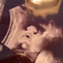 루아산부인과의원 | [임신/출산일기] 한국에서의 기록, 그리고 루아와 만난 이야기