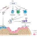 동천센트럴치과의원 | 동천역 치과, 잇몸뼈 녹음 도움되는 방법들 알려드릴게요.