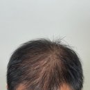 대구SMP